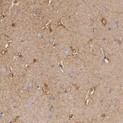 Immunohistochemistry-Paraffin: Creatine Kinase BB Antibody [NBP1-84460]
