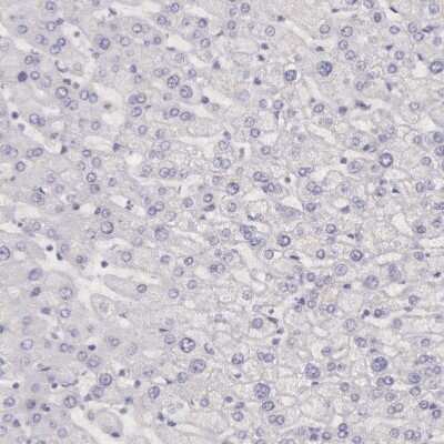 Immunohistochemistry-Paraffin: Creatine Kinase BB Antibody [NBP1-84460]