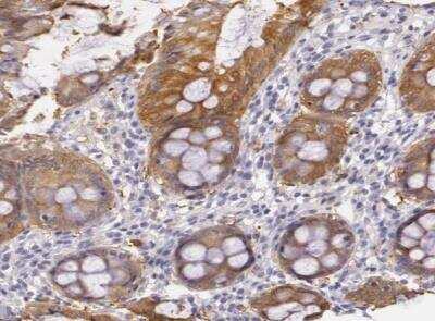Immunohistochemistry-Paraffin: Creatine Kinase BB Antibody [NBP1-84460]