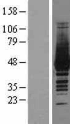 Western Blot: Creatine Kinase, Muscle/CKMM Overexpression Lysate [NBL1-09221]