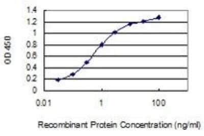 ELISA: Creatine Kinase, Muscle/CKMM Antibody (1E3) [H00001158-M02]