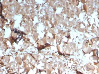 Immunohistochemistry-Paraffin: Creatine Kinase, Muscle/CKMM Antibody (CKMM/3341) - Azide and BSA Free [NBP3-08304]