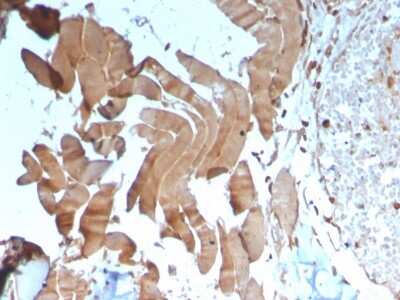 Immunohistochemistry-Paraffin: Creatine Kinase, Muscle/CKMM Antibody (CKMM/3341) [NBP3-07560]