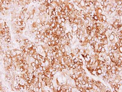 Immunohistochemistry-Paraffin: Creatine kinase MT 1A Antibody [NBP2-16005]