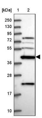 Western Blot: Creatine kinase MT 1A Antibody [NBP2-13840]