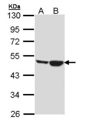 Western Blot: Creatine kinase MT 1A Antibody [NBP2-16005]