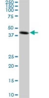 Western Blot: Creatine kinase MT 1B Antibody (2C8) [H00001159-M04]