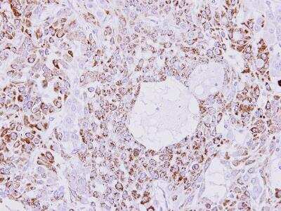 Immunohistochemistry-Paraffin: Creatine kinase MT 1B Antibody [NBP1-31543]