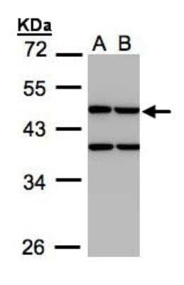 Western Blot: Creatine kinase MT 1B Antibody [NBP1-31543]