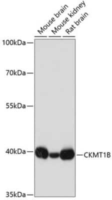 Western Blot: Creatine kinase MT 1B AntibodyAzide and BSA Free [NBP3-05655]