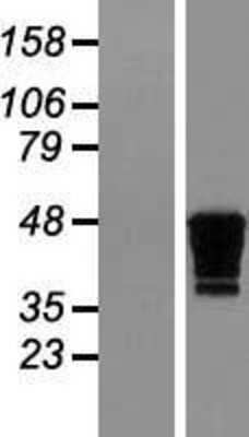 Western Blot: Creatine kinase MT 1B Overexpression Lysate [NBL1-09222]