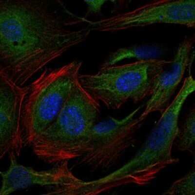 Immunocytochemistry/ Immunofluorescence: Crk Antibody (3G11E8) - BSA Free [NBP2-37568]