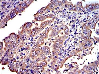 Immunohistochemistry: Crk Antibody (3G11E8) - BSA Free [NBP2-37568]