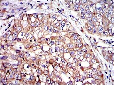 Immunohistochemistry: Crk Antibody (3G11E8) - BSA Free [NBP2-37568]