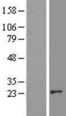 Western Blot: Crk Overexpression Lysate [NBL1-09484]