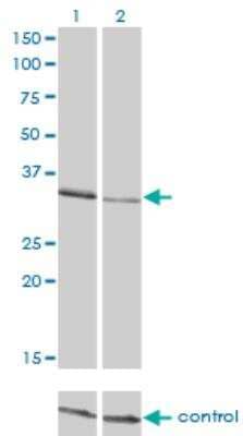 Western Blot: CrkL Antibody (4B5) [H00001399-M03]