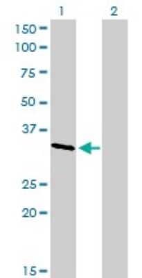 Western Blot: CrkL Antibody (4B5) [H00001399-M03]