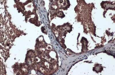 Immunohistochemistry-Paraffin: CrkL Antibody (GT466) [NBP3-13625]