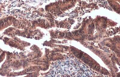 Immunohistochemistry-Paraffin: CrkL Antibody (GT466) [NBP3-13625]