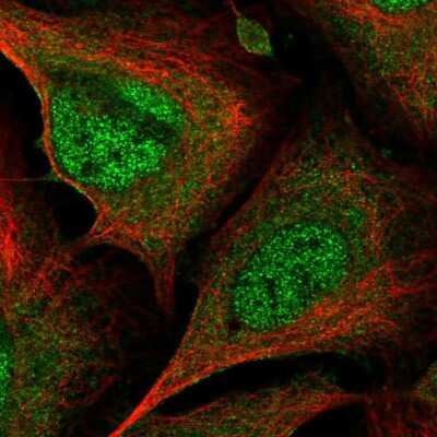 Immunocytochemistry/ Immunofluorescence: CrkL Antibody [NBP2-55130]