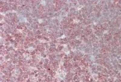 Immunohistochemistry-Paraffin: CrkL Antibody [NB300-884]