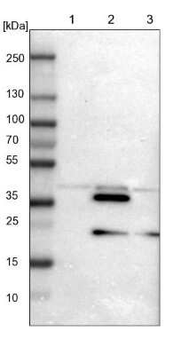 Western Blot: CrkL Antibody [NBP1-86181]