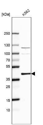 Western Blot: CrkL Antibody [NBP2-55130]