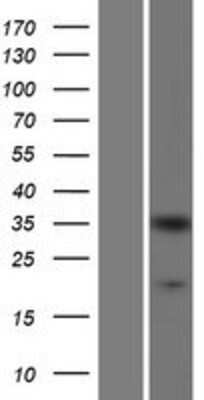 Western Blot: CrkL Overexpression Lysate [NBP2-07776]