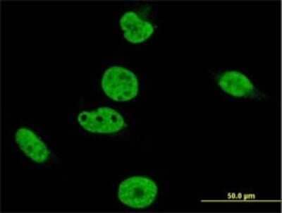 Immunocytochemistry/ Immunofluorescence: CrkRS Antibody (1H4) [H00051755-M01]