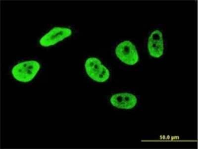 Immunocytochemistry/ Immunofluorescence: CrkRS Antibody (3C1) [H00051755-M04]