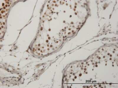 Immunohistochemistry-Paraffin: CrkRS Antibody (3C1) [H00051755-M04]