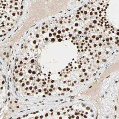 Immunohistochemistry-Paraffin: CrkRS Antibody [NBP1-85451]