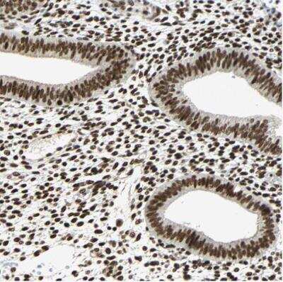 Immunohistochemistry-Paraffin: CrkRS Antibody [NBP1-85451]