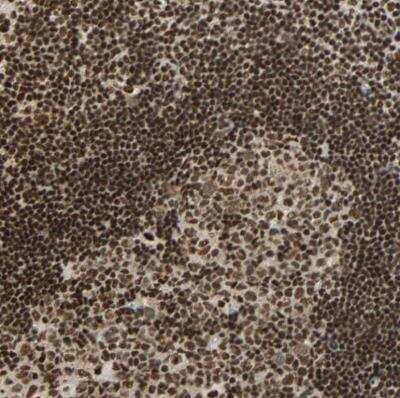 Immunohistochemistry-Paraffin: CrkRS Antibody [NBP1-85451]