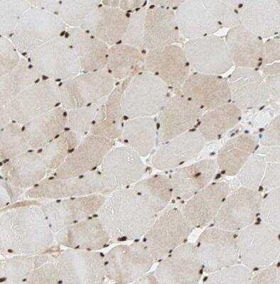 Immunohistochemistry-Paraffin: CrkRS Antibody [NBP1-85451]