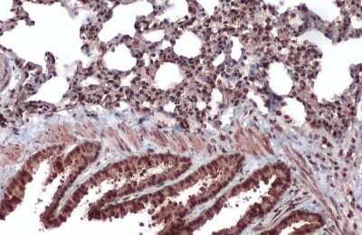 Immunohistochemistry-Paraffin: CrkRS Antibody [NBP3-12958]