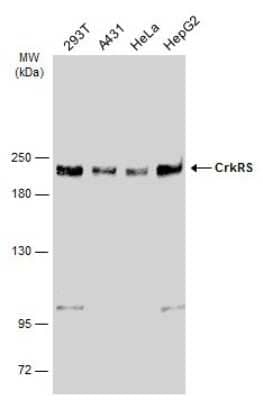 Western Blot: CrkRS Antibody [NBP3-12958]