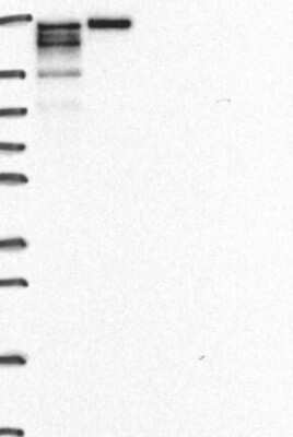 Western Blot: CrkRS Antibody [NBP3-17236]