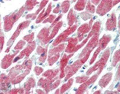 Immunohistochemistry-Paraffin: AlphaB Crystallin/CRYAB Antibody (1B6.1-3G4) [NBP1-97494]