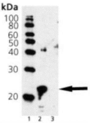 Western Blot: AlphaB Crystallin/CRYAB Antibody (1B6.1-3G4) [NBP1-97494]