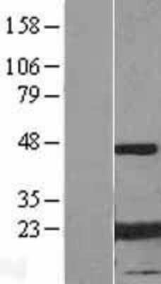 Western Blot: AlphaB Crystallin/CRYAB Overexpression Lysate [NBL1-09497]