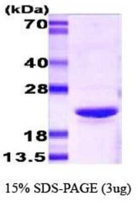 SDS-PAGE: Recombinant Mouse AlphaB Crystallin/CRYAB Protein [NBC1-18376]