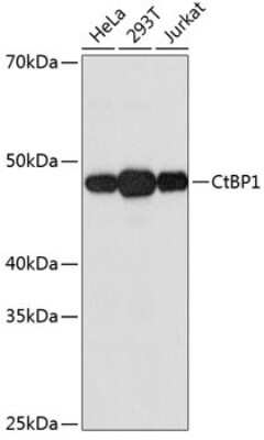 Western Blot: CtBP1 Antibody (1I7G6) [NBP3-15412]