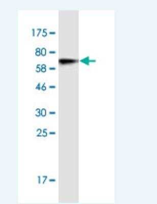 Western Blot: CtBP1 Antibody (2G11) [H00001487-M04-100ug]