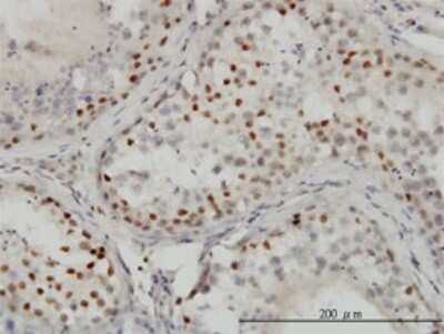 Immunohistochemistry-Paraffin: CtBP1 Antibody (2G7) [H00001487-M01]