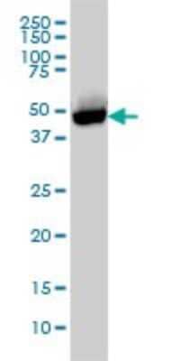 Western Blot: CtBP1 Antibody (2G7) [H00001487-M01]