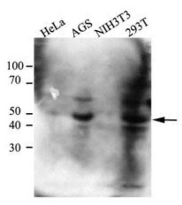 Western Blot: CtBP1 Antibody (4D6)BSA Free [NBP1-74040]