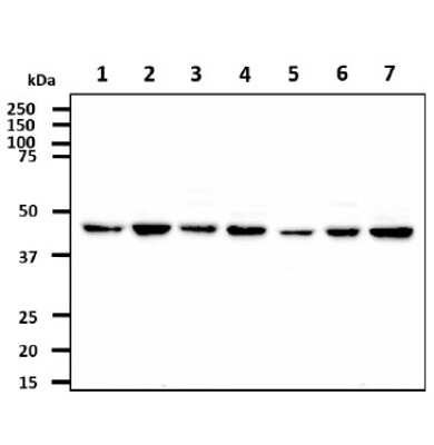Western Blot: CtBP1 Antibody (4D6)BSA Free [NBP1-74040]