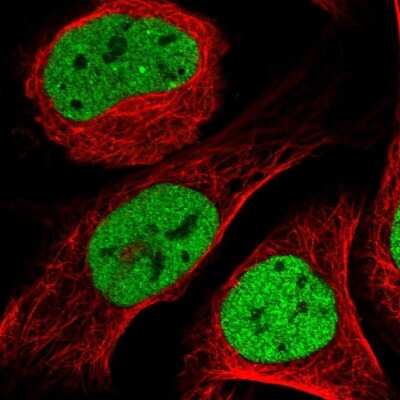 Immunocytochemistry/ Immunofluorescence: CtBP1 Antibody [NBP1-88707]