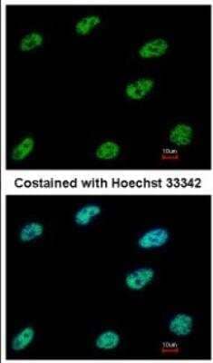 Immunocytochemistry/ Immunofluorescence: CtBP1 Antibody [NBP2-16023]